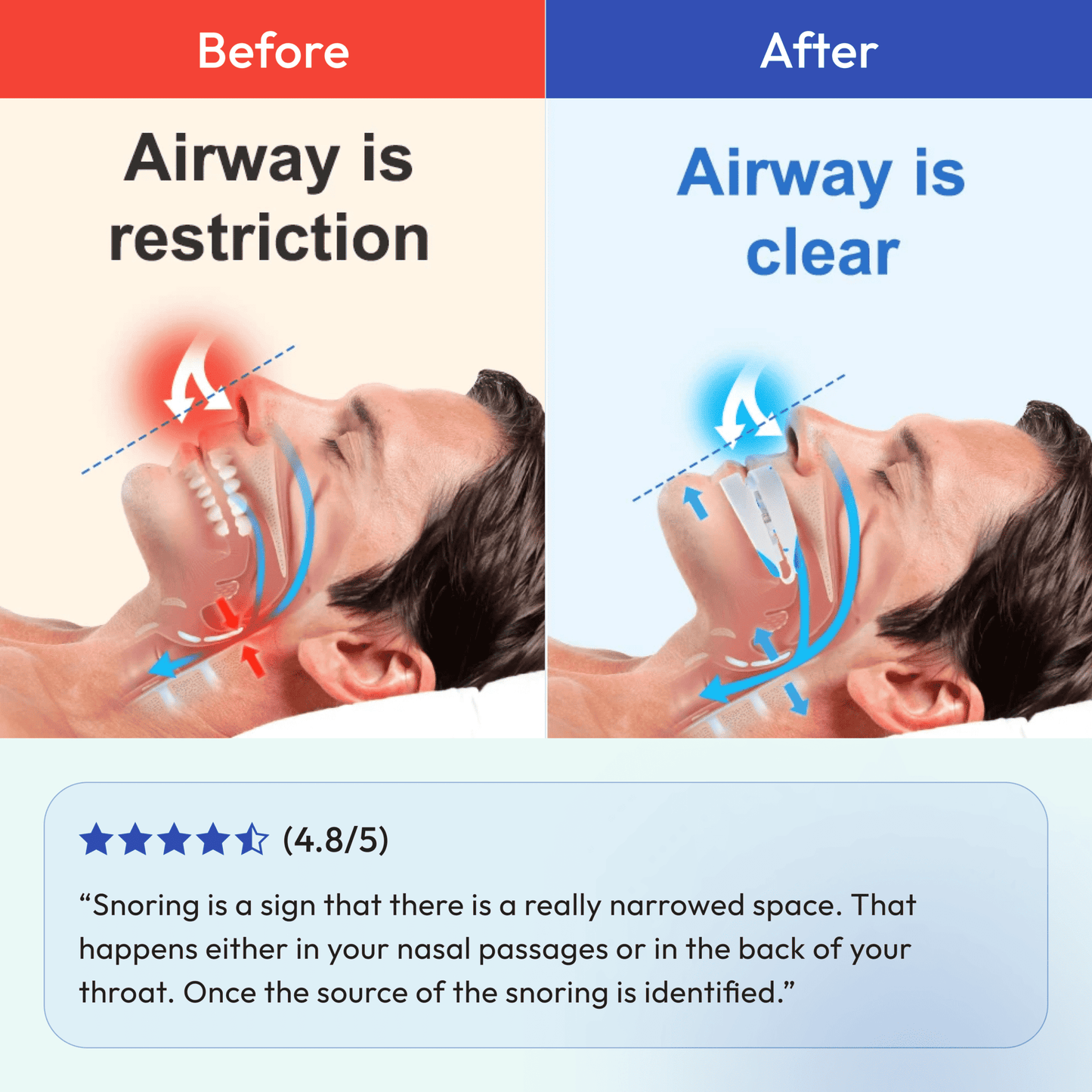 Honex Ultimate Anti-Snoring Kit - Address & Fixes All 3 Causes of Snoring (Built on Harvard Research)